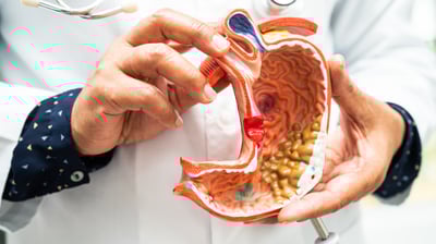 Hábitos comunes que afectan tu metabolismo