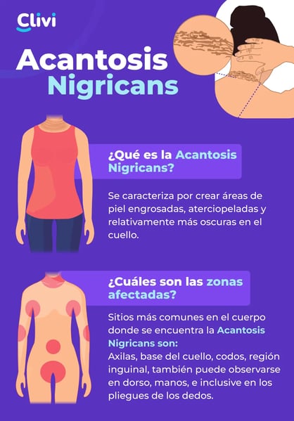acantosis-nigricans infografía