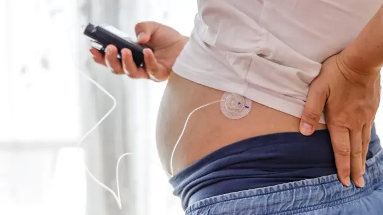 bomba-de-insulina-uso