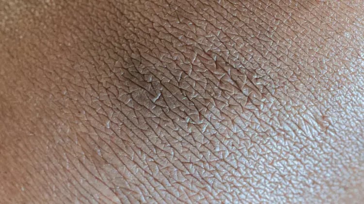 mancha-negra-67d9b8db8da3e